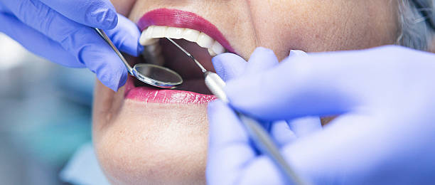 Best Emergency Treatment for Dental Infections or Abscesses in Grandview Heights, OH